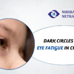 Dark Circles and Eye Fatigue in Children