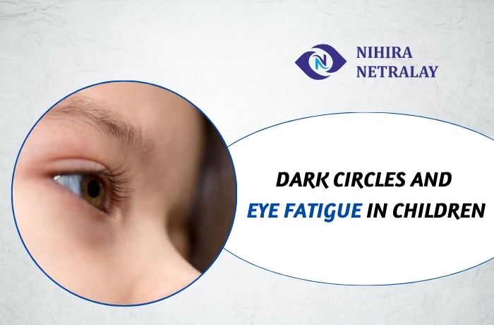 Dark Circles and Eye Fatigue in Children