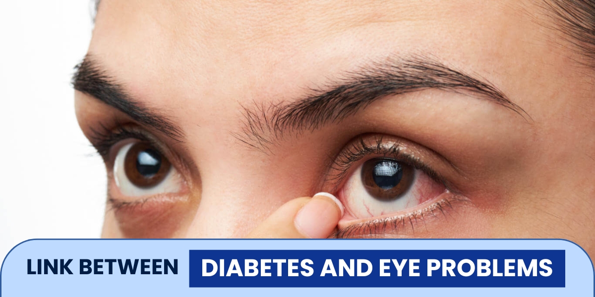 Link Between Diabetes and Eye Problems