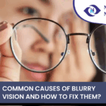 Common Causes of Blurry vision