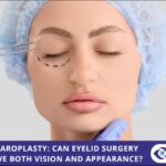 Blepharoplasty