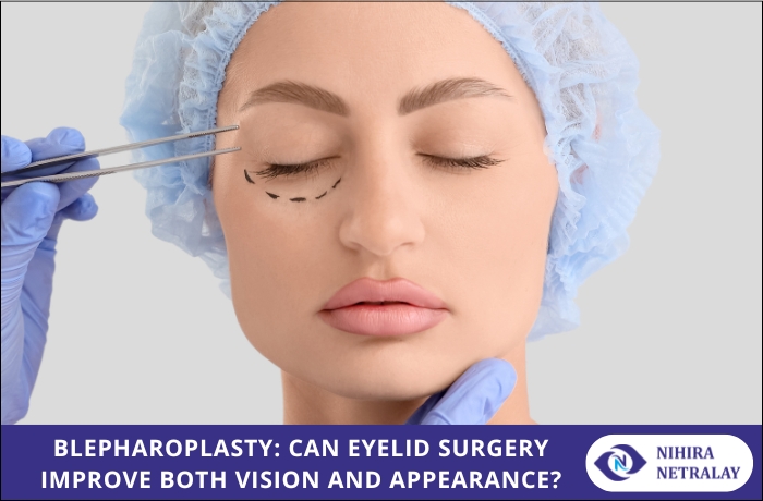 Blepharoplasty