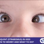 Squint (Strabismus) in Kids