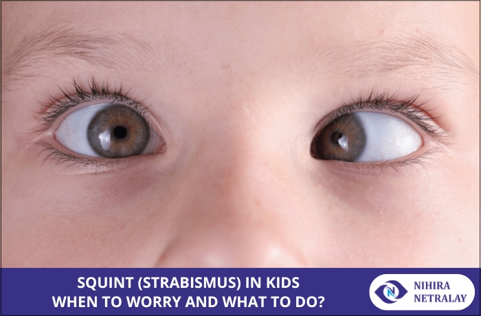 Squint (Strabismus) in Kids