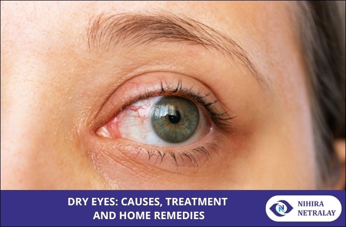 Dry Eyes - Causes and Symptoms
